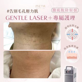 （分類：）位於 。 由 metabeautylab 提交（商品編號 1293245281，圖片 1）。簡介： 。