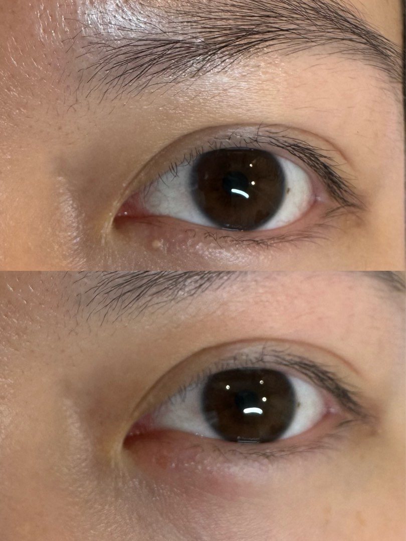 （分類：）位於 。 由 skingeneo62082087 提交（商品編號 1355791685，圖片 1）。簡介： 。