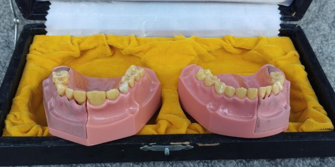 Dentistry Pediatric dentition dental development sample model P1- 6008 (Category: Medical Supplies & Tools) located in Manila. Submitted by benjie.benjie3 (Listing ID 1356346450, Image 2). Description: Dentistry Pediatric dentition dental development sample model P1- 6008 From Japan 2nd hand with scratch No warranty If there's Damage or Issues they can be seen in the last picture Price = 1,000 pesos My location is Malabon city Price does not incl