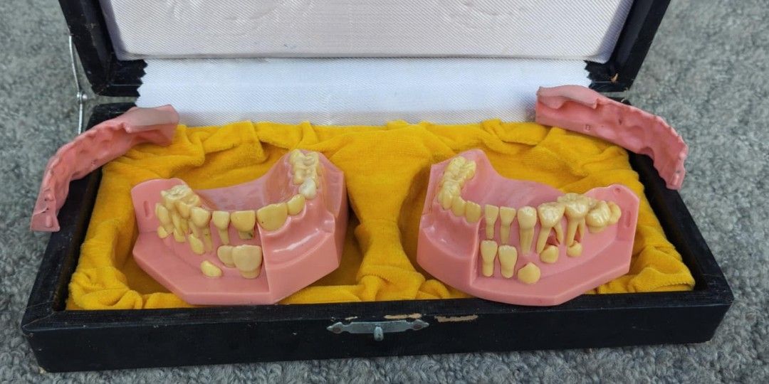 Dentistry Pediatric dentition dental development sample model P1- 6008 (Category: Medical Supplies & Tools) located in Manila. Submitted by benjie.benjie3 (Listing ID 1356346450, Image 3). Description: Dentistry Pediatric dentition dental development sample model P1- 6008 From Japan 2nd hand with scratch No warranty If there's Damage or Issues they can be seen in the last picture Price = 1,000 pesos My location is Malabon city Price does not incl