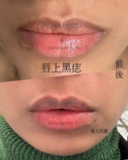 （分類：）位於 。 由 allaboutlazy_hk 提交（商品編號 1364680850，圖片 1）。簡介： 。