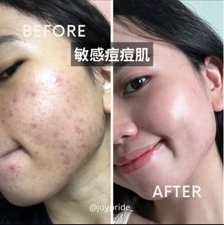 （分類：）位於 。 由 joy_ll 提交（商品編號 1362773236，圖片 1）。簡介： 。