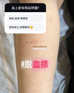 （分類：）位於 。 由 allaboutlazy_hk 提交（商品編號 1368898579，圖片 1）。簡介： 。