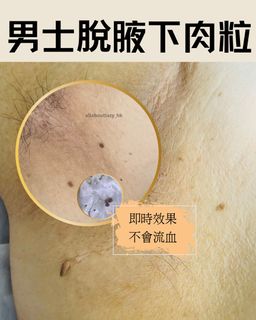 （分類：）位於 。 由 allaboutlazy_hk 提交（商品編號 1369523072，圖片 1）。簡介： 。