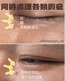 （分類：）位於 。 由 allaboutlazy_hk 提交（商品編號 1370272429，圖片 1）。簡介： 。