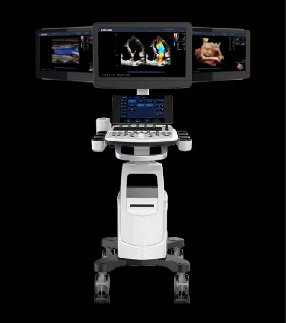 Ultrasound Machine Chison (Category: Medical Supplies & Tools) located in Angeles City. Submitted by ryainramos (Listing ID 1370473502, Image 2). Description: 4 probes.