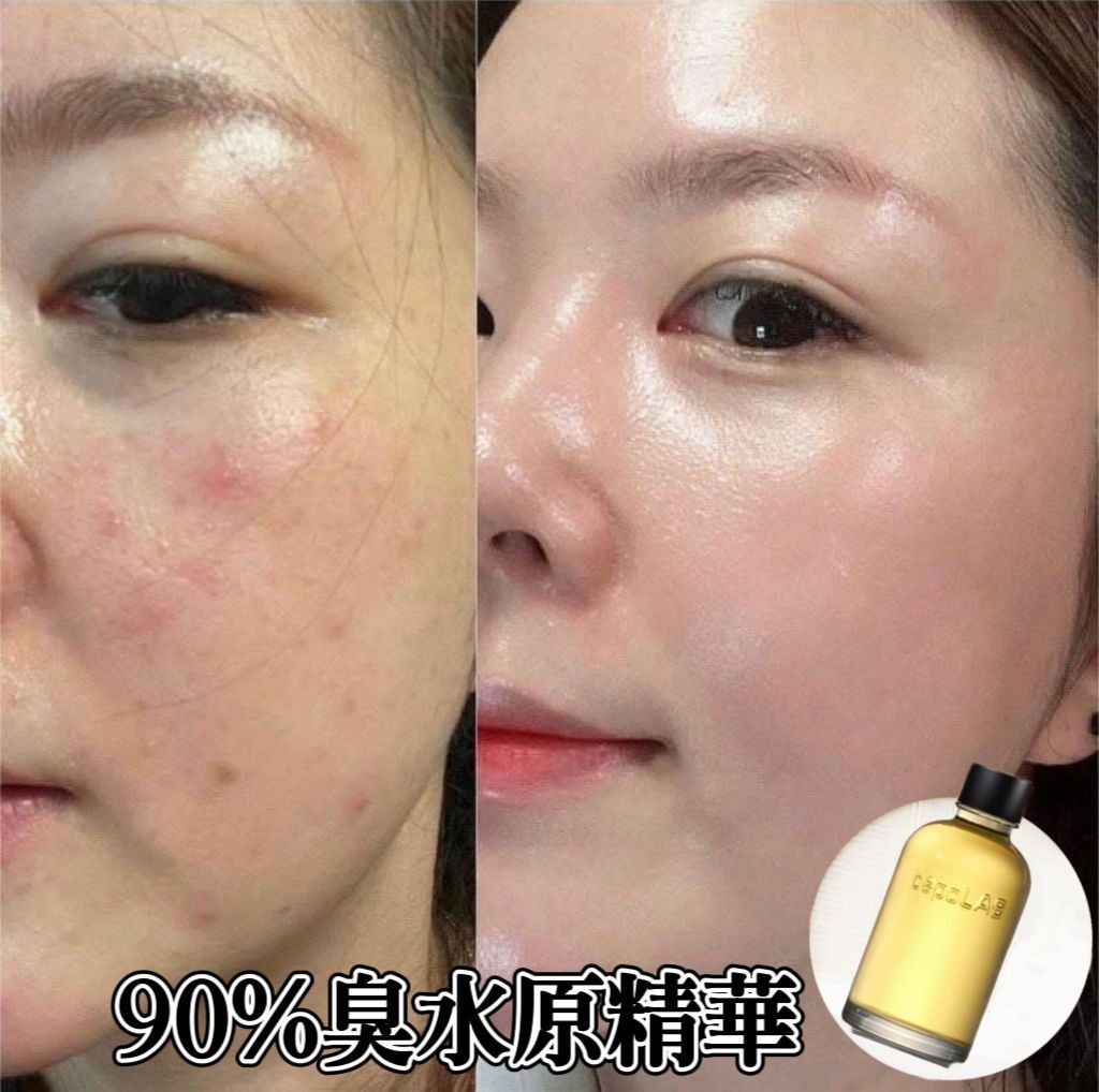 韓國 90%臭水原精華 （分類：面部 - 面部護理）位於 Hong Kong。 由 life_pro 提交（商品編號 1371995013，圖片 2）。簡介： 90%臭水原精華 ➡具有強大生命力的生理活性物質，奈米顆粒滲透至皮膚深處，提供黃金能量，喚醒沉睡的皮膚細胞，對抗老化跡象，提升皮膚質素，促進皮膚的自然健康‼ ✨92.8%CLEPS濃縮物：有強大的皮膚效果，有助於皮膚健康，促進減少皮膚老化因素，滋潤並平滑肌膚 ✨丁二醇：滋潤保濕、抗炎、抗過敏，幫助肌膚鎖住水分，防止皮膚水分流失，避免出現皮膚乾燥、脫皮 ✨透明質酸鈉：提升皮膚質素，令皮膚保濕飽滿，打擊自由基，促進膠原蛋白增生，保持皮膚彈性 ✨使用4周後，皮膚密度+20.10%，皮膚粗糙度-11.10%，皮膚填充+51.55% ✨使用方法：潔面後，取適量塗抹於肌膚，輕輕拍打按摩 ✨韓國製。
