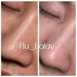 （分類：）位於 。 由 imhere_rulalay 提交（商品編號 1367913813，圖片 1）。簡介： 。