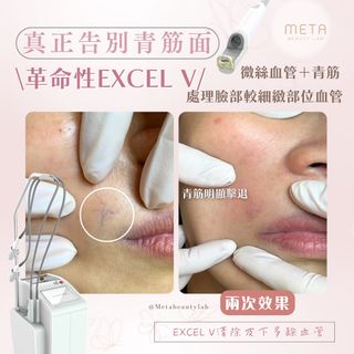 （分類：）位於 。 由 metabeautylab 提交（商品編號 1297277065，圖片 1）。簡介： 。