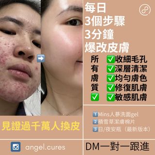 （分類：）位於 。 由 angel.cures 提交（商品編號 1375238215，圖片 1）。簡介： 。