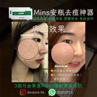 （分類：）位於 。 由 divstore.hk 提交（商品編號 1256862774，圖片 1）。簡介： 。