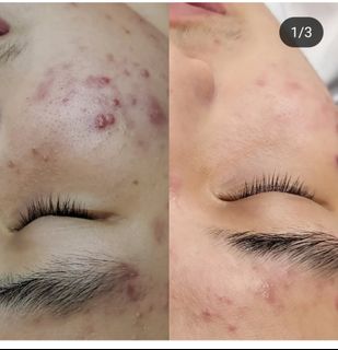 (Category: ) located in . Submitted by eyelash.extensions (Listing ID 1381044611, Image 1). Description: .