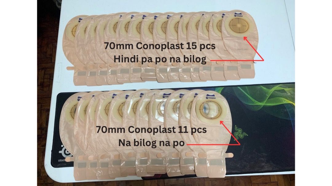 Convatec Active Life (Category: Medical Supplies & Tools) located in Quezon City. Submitted by ryan976 (Listing ID 1381212968, Image 3). Description: Bundle Sale Details: ConvaTec Active Life Ref 22771 70mm 16 pcs ostomy bag *Note: Na bilog na po, para hindi na mahirapan mag butas* Conoplast 70mm 15 pcs ostomy bag 70mm 11 pcs ostomy bag - *Note: Na bilog na po, para hindi na mahirapan mag butas* Brand less ostomy bag 65mm 9 pcs ostomy bag combina