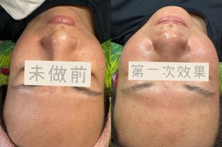 （分類：）位於 。 由 imhere_rulalay 提交（商品編號 1381662130，圖片 1）。簡介： 。