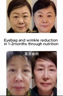 (Category: ) located in . Submitted by hueyninggg (Listing ID 1383243444, Image 1). Description: .