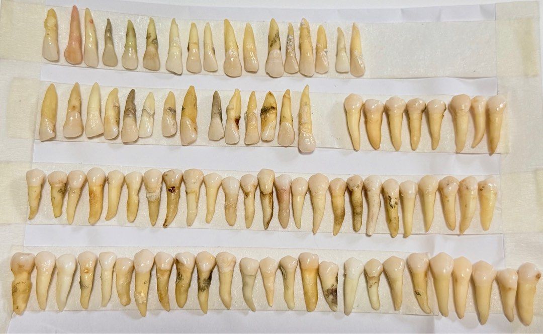 Natural Tooth (Category: Medical Supplies & Tools) located in Manila. Submitted by abubotatbp (Listing ID 1284121609, Image 3). Description: No return/ No exchange of item What you see is what you get Can take a close picture of the teeth No reservations Set will be prioritized!!! P2,800 per set P800 per quadrant P100/each Anterior teeth (central, lateral, canine, premolars) P150/each Birooted Premolar good for endo P250/each Maxillary and Mandib
