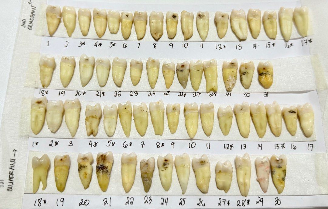 Natural Tooth (Category: Medical Supplies & Tools) located in Manila. Submitted by abubotatbp (Listing ID 1284121609, Image 2). Description: No return/ No exchange of item What you see is what you get Can take a close picture of the teeth No reservations Set will be prioritized!!! P2,800 per set P800 per quadrant P100/each Anterior teeth (central, lateral, canine, premolars) P150/each Birooted Premolar good for endo P250/each Maxillary and Mandib