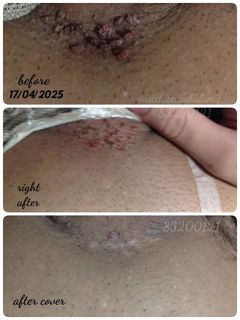 (Category: ) located in . Submitted by institutcarebalance.223 (Listing ID 1379186085, Image 1). Description: .