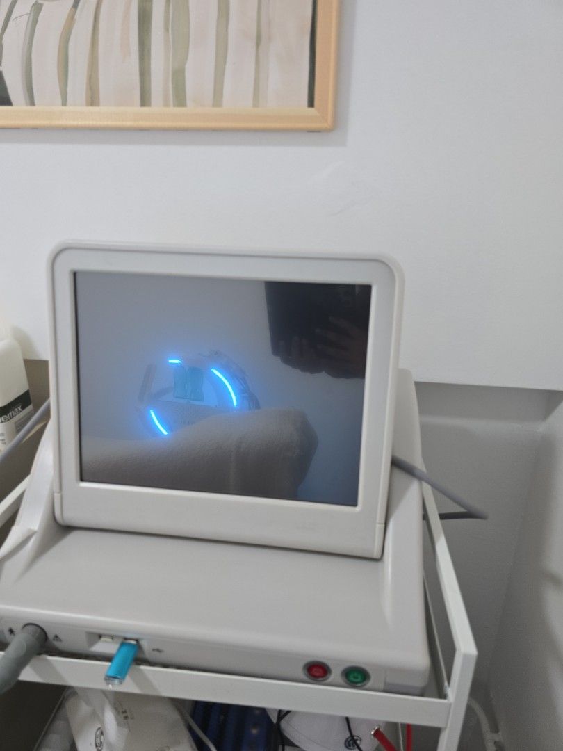 Hifu machine (Category: Face Care) located in Singapore. Submitted by gayathrilakshminarayana (Listing ID 1379402699, Image 2). Description: Condition is like new. I only used it once. After that, I didn’t have time to use it..