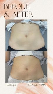 （分類：）位於 。 由 hbabymart 提交（商品編號 1385379564，圖片 1）。簡介： 。