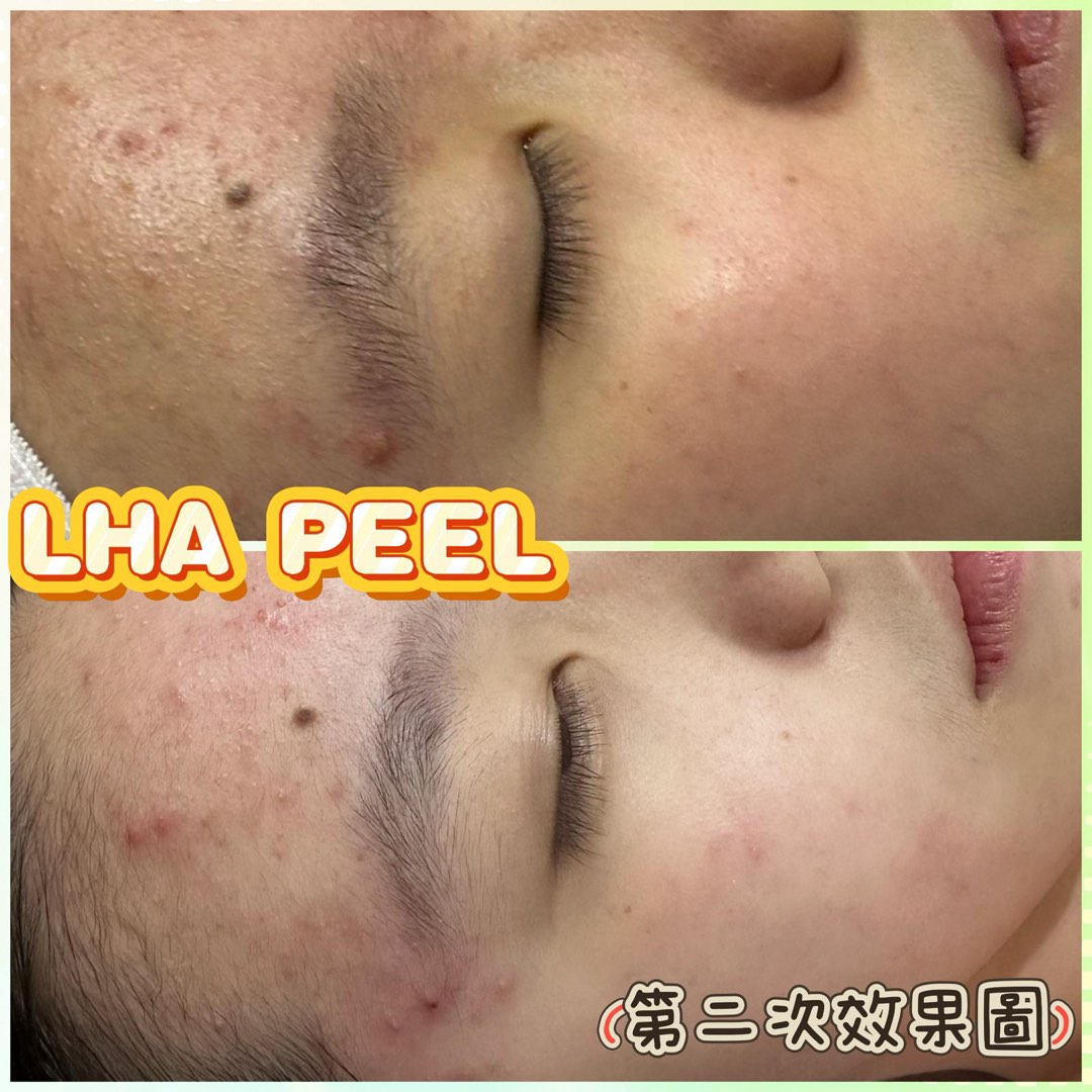 (分類:)位於 。 由 Girlstore 提交(商品編號 1389553460,圖片 1)。簡介: 。
