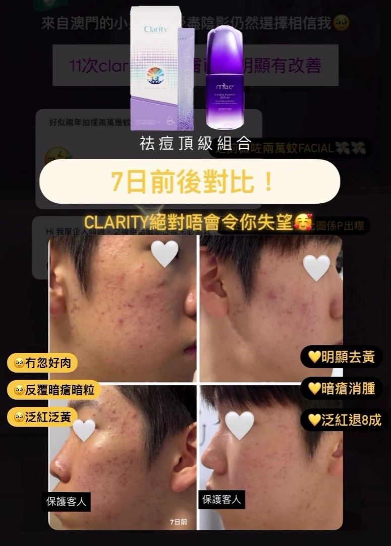 Clarity 面膜組合全港唯一粉狀面膜｜Clarity / 小紫瓶精華任意搭配三盒，送一盒安瓶修復面膜一盒五塊價值$395 勁貼面