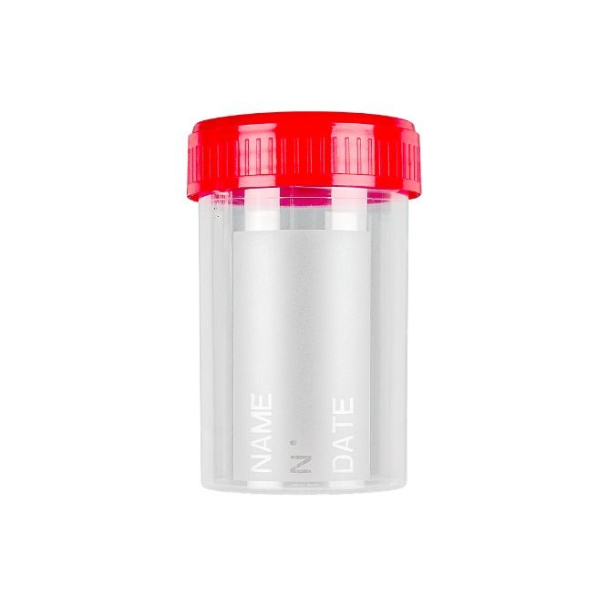 SURRMED Urine Container Specimen Cup (Category: Medical Supplies & Tools) located in Quezon City. Submitted by andrea_dxs (Listing ID 1415639428, Image 1). Description: SURRMED Urine Container Specimen Container Designed to collect and store solid or liquid samples , including food , medicine , urine and feces also opaque containers ideal for photo sensitive samples or when it is required not to show the content. Security seal on cap and cup to p