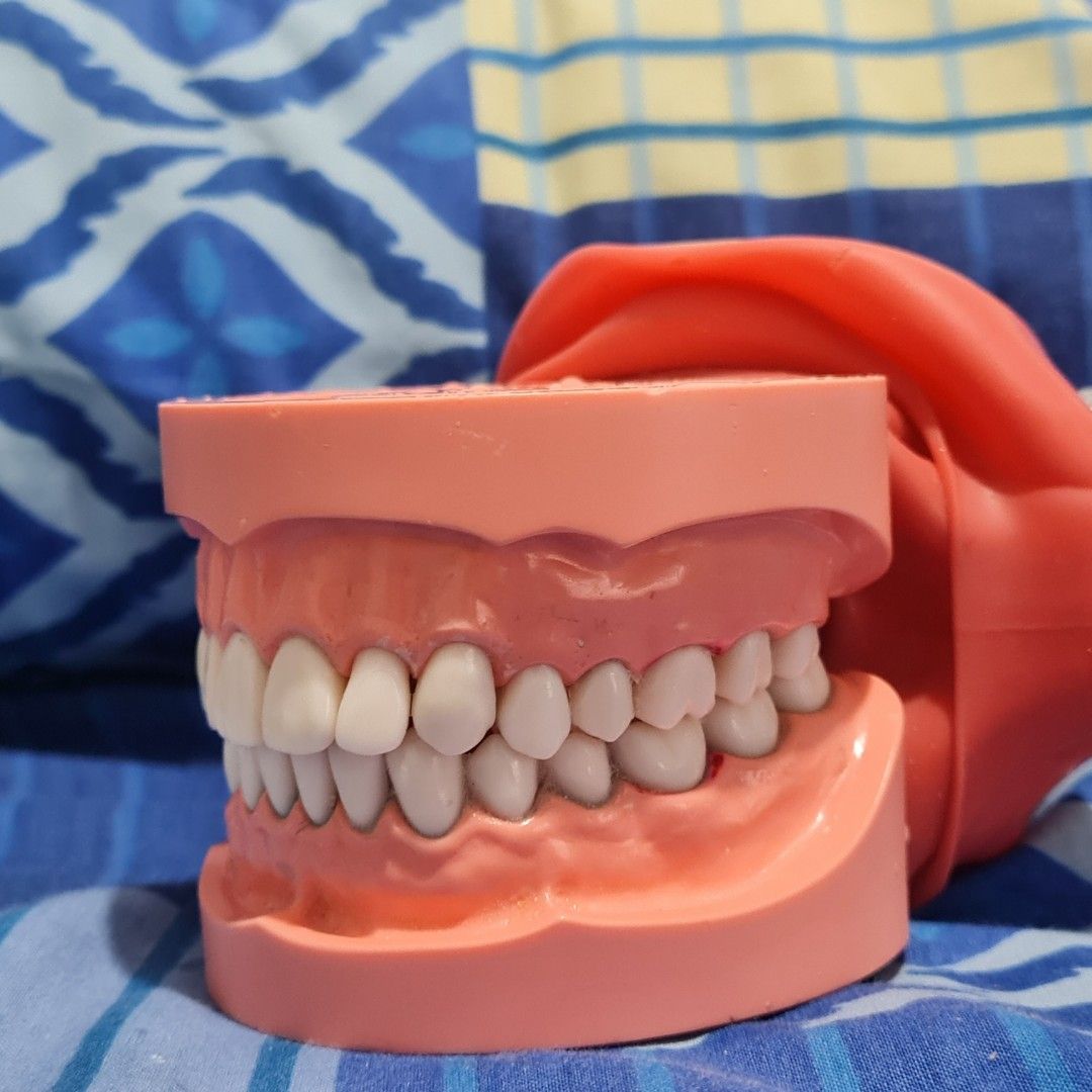 Dental Teeth Model (Category: Looking For) located in Quezon City. Submitted by LimitlessGamer (Listing ID 1418202958, Image 2). Description: Rfs: Shifting courses na good as new. Wala na box tho, pero kasama na rubber cheeks..