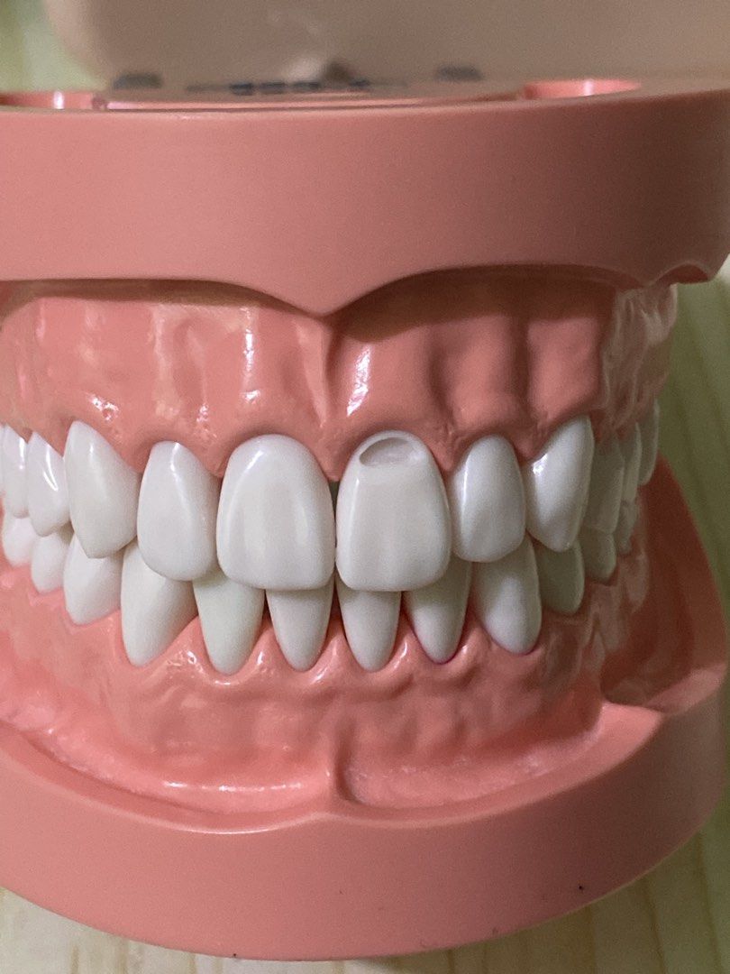 Dental Typodont Teeth Model with Articulator TRM-263 (Category: Medical Supplies & Tools) located in Manila. Submitted by brightearth.a59ddb (Listing ID 1467985083, Image 1). Description: - may 2 scratches na visible naman sa pics GET NIYO NA PLSSS.