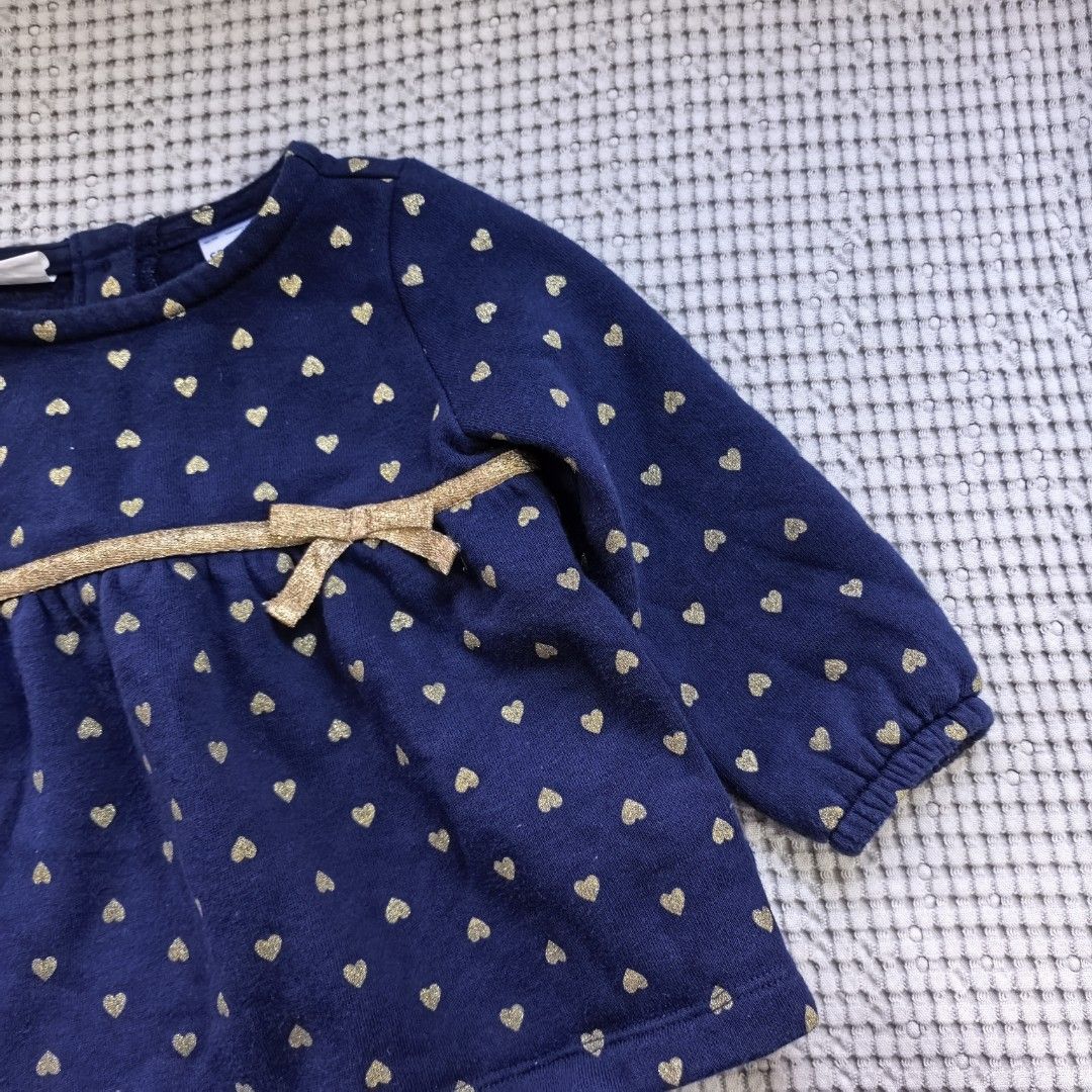 CARTER'S (12mos) (Category: Babies & Kids Fashion) located in Cebu City. Submitted by stealmycloset_ (Listing ID 1465397756, Image 2). Description: .