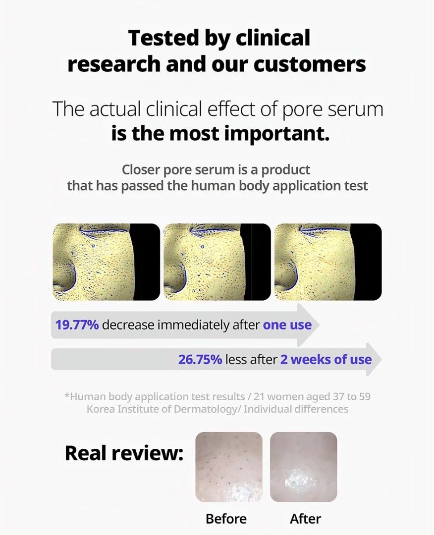Frankly Closer Pore Reducing Serum Peptide 9 (Category: Face Care) located in Manila. Submitted by goddesssy (Listing ID 1470026751, Image 2). Description: - 100% Authentic K-Beauty: Frankly Closer Pore Reducing Serum - Key Ingredients: Peptide 9, Adenosine, and PHA for effective pore care - Safe & Ethical: Vegan, cruelty-free, and pregnancy-safe formulation - How to Use: Apply 1-2 drops daily, morning and evening, after toning - Suitable For: Fa