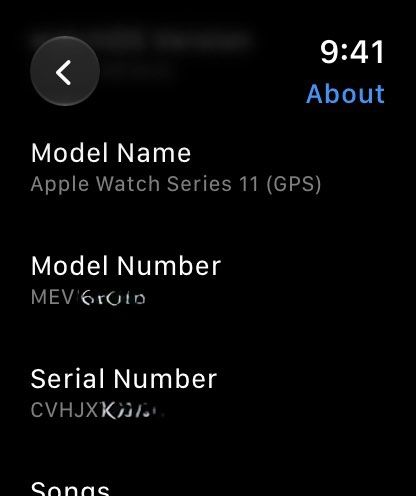 Apple Watch Series 11 (Category: Wearables & Smart Watches) located in Manila. Submitted by calvincurates (Listing ID 1470291035, Image 3). Description: - Model: Apple Watch Series 11 46mm Space Gray - Condition: Excellent, well-maintained - Complete inclusions - Battery Health: 100% maximum capacity - Meetup Location: Market! Market!, BGC, Taguig City - ₱18,000 (still negotiable).