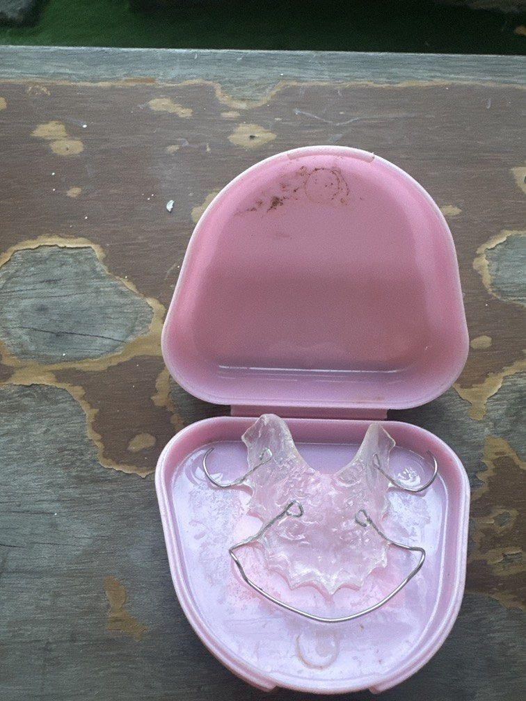 Dentist Retainer Fashion (Category: Medical Supplies & Tools) located in Manila. Submitted by xenasales (Listing ID 1471021952, Image 1). Description: .