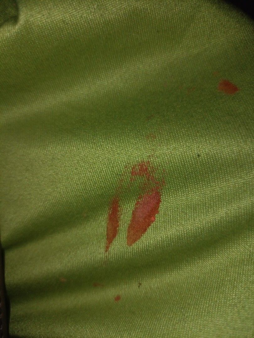 Keroppi sanrio shirt (Category: Shirts) located in Manila. Submitted by vastfish.e9bc58 (Listing ID 1470957815, Image 3). Description: open slit under Keroppi's foot. paint stains on left sleeve.