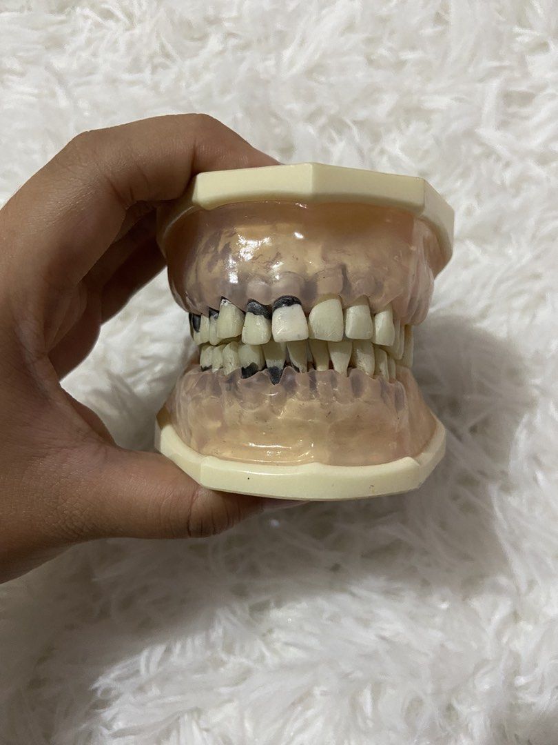 Trimunt Perio jaw (Category: Stationery & School Supplies) located in Manila. Submitted by alexbear.2001 (Listing ID 1465583447, Image 2). Description: -minor lacerations (lower anterior) -with box.