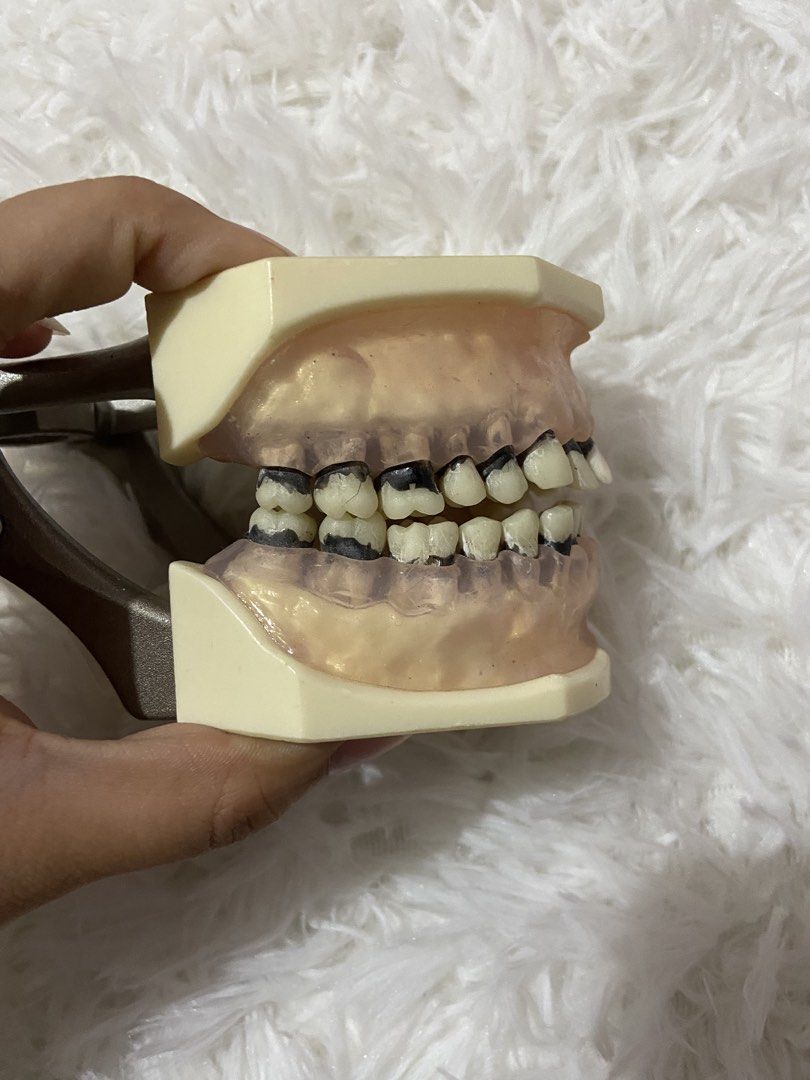 Trimunt Perio jaw (Category: Stationery & School Supplies) located in Manila. Submitted by alexbear.2001 (Listing ID 1465583447, Image 1). Description: -minor lacerations (lower anterior) -with box.