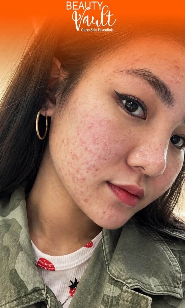 Beauty Vault Rejuvenating Set (Category: Face Care) located in Manila. Submitted by jadrianzen (Listing ID 1466219095, Image 2). Description: Beauty Vault Rejuvenating Set is the secret to clear glowing skin ✨🧡 📌Removes Pimples 📌 Lightens pimple marks and dark spots 📌 Whitens face 📌Tightens Pores Whats in the box? - Soap - Toner - Night Cream - Sunblock Cream How to Use? You may refer at the back of the box. #beautyVaultRejuv.