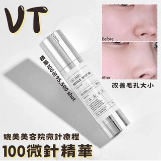 （分類：）位於 。 由 lkl_chk 提交（商品編號 1466559828，圖片 1）。簡介： 。
