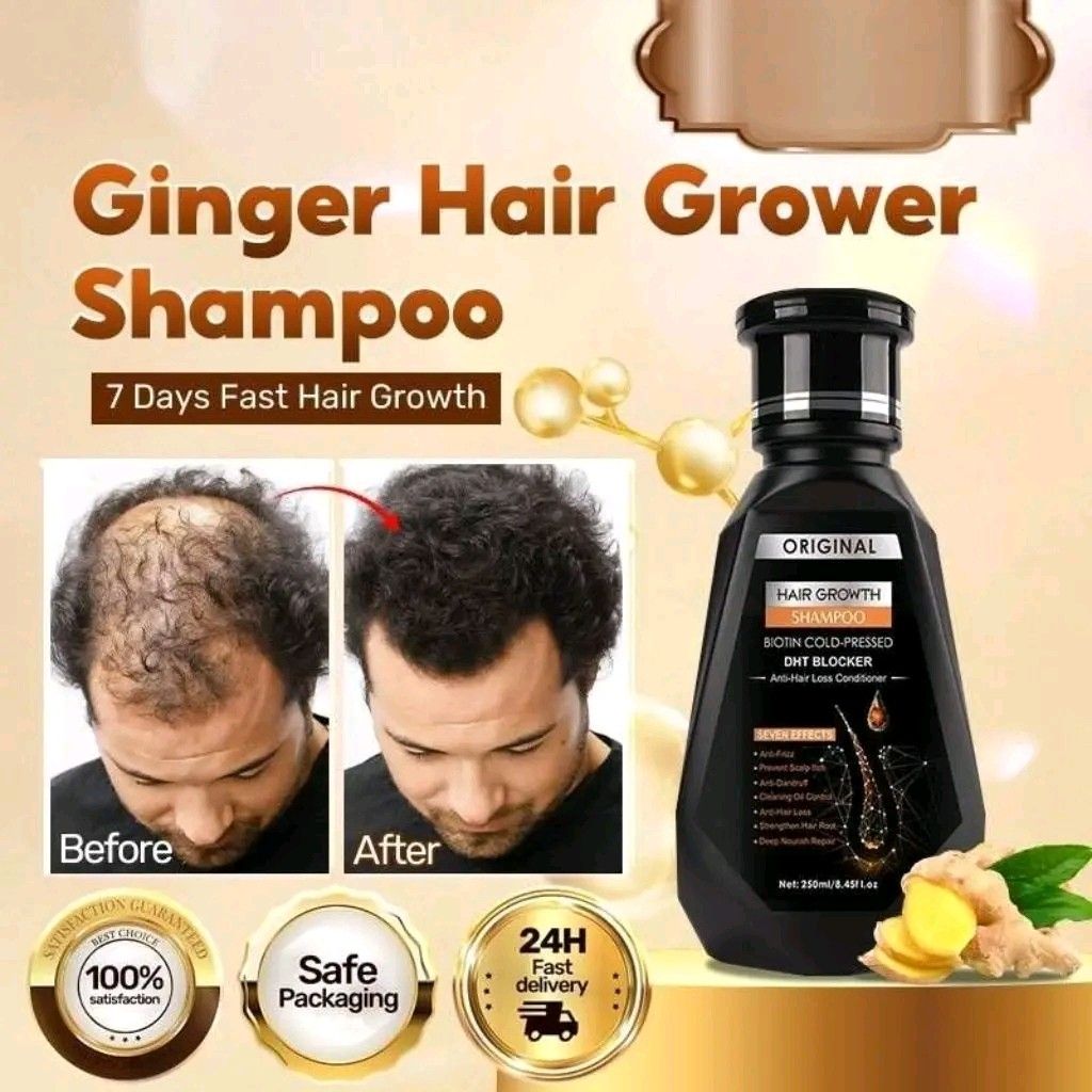 Shampoo pampatubo ng buhok (Category: Hair) located in Manila. Submitted by nazmanaziz79 (Listing ID 1422657997, Image 2). Description: - Hair Growth Shampoo - Promotes hair growth - DHT Blocker - Contains Biotin - 250ml bottle - Anti-hair loss conditioner - Helps with dandruff and oil control 599 for 2 pcs.