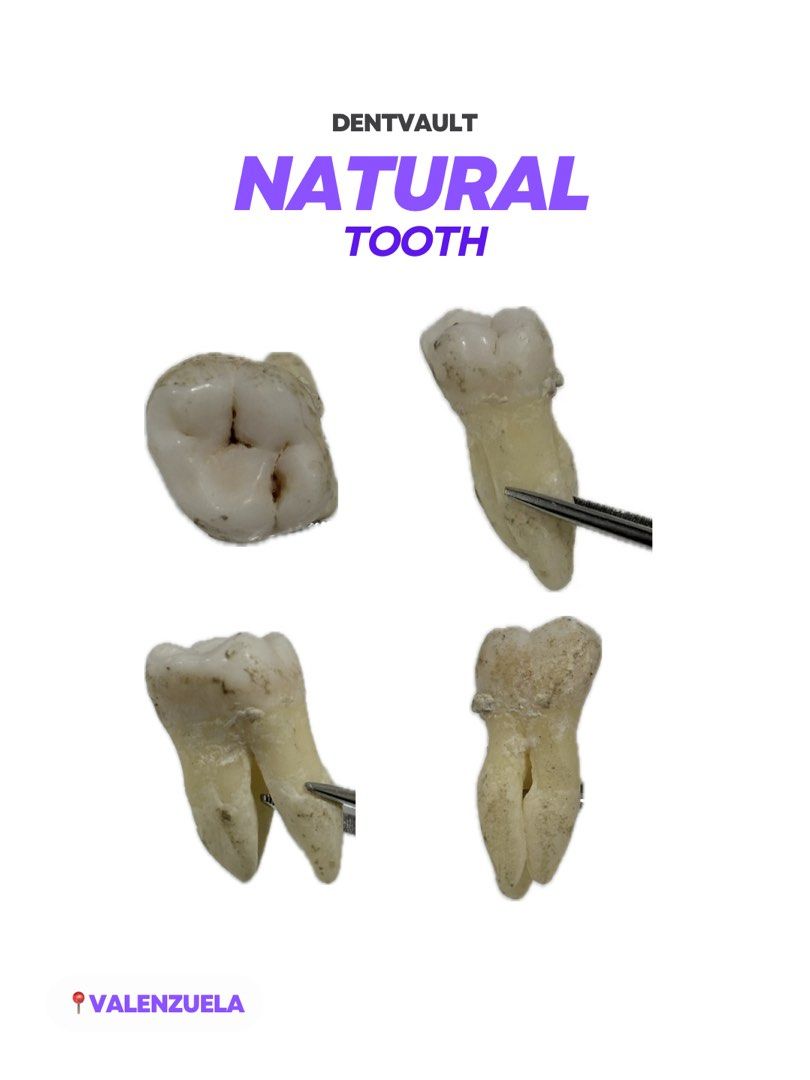 NATURAL TOOTH (Category: Medical Supplies & Tools) located in Manila. Submitted by dentvault_ (Listing ID 1425978109, Image 1). Description: Random NATURAL TOOTH for sale!! ₱90 each Please save the photo of the tooth you want to buy and send it via chat. .