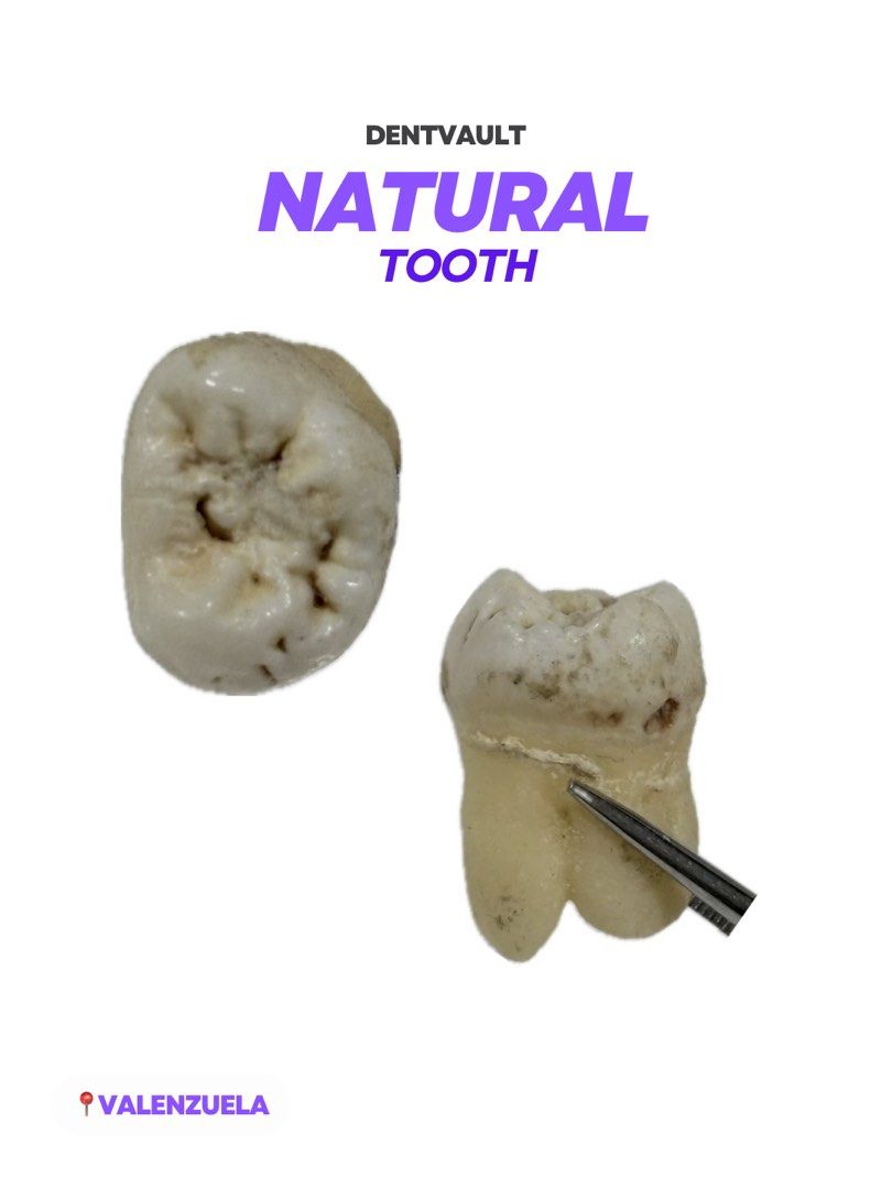 NATURAL TOOTH (Category: Medical Supplies & Tools) located in Manila. Submitted by dentvault_ (Listing ID 1425978109, Image 2). Description: Random NATURAL TOOTH for sale!! ₱90 each Please save the photo of the tooth you want to buy and send it via chat. .