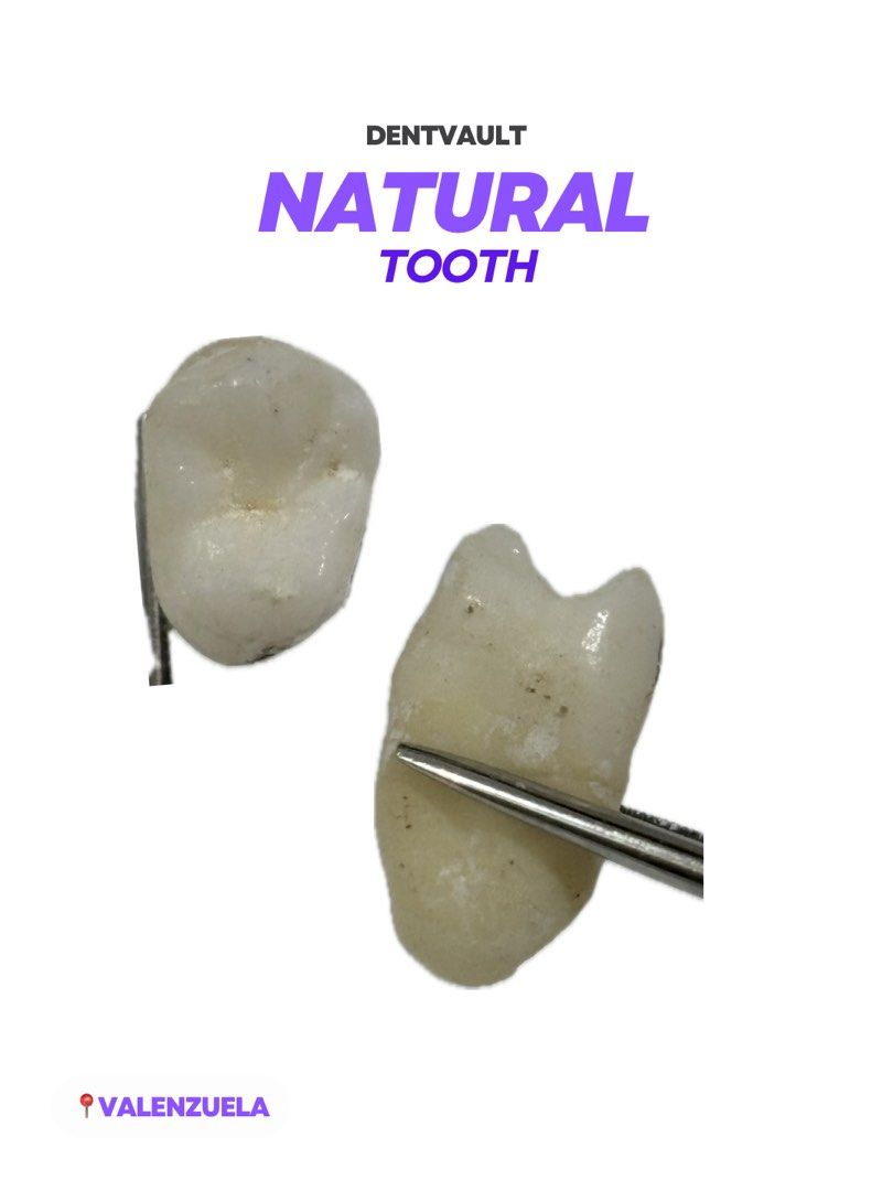 NATURAL TOOTH (Category: Medical Supplies & Tools) located in Manila. Submitted by dentvault_ (Listing ID 1425978109, Image 3). Description: Random NATURAL TOOTH for sale!! ₱90 each Please save the photo of the tooth you want to buy and send it via chat. .