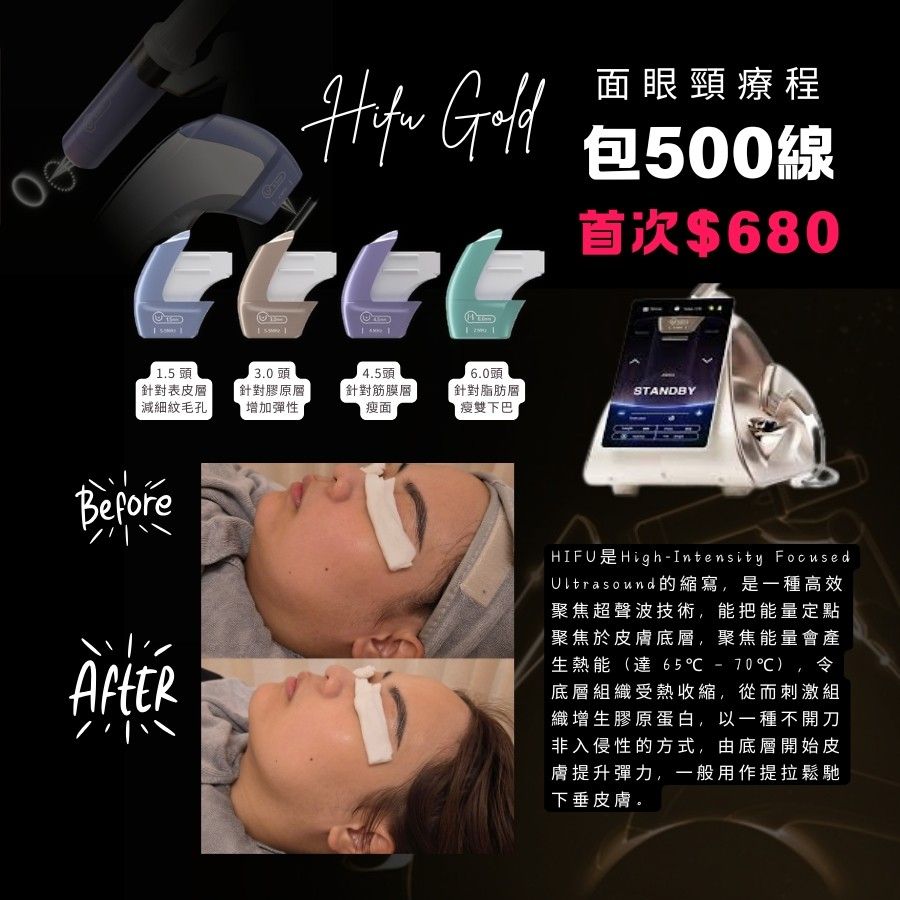 Hifu療程/ 膠原槍療程$680 hifu gold 超聲刀 膠原槍 膠原自生 生膠原 膠原bb槍 射頻療程 瘦面療程 vmax 無針埋線 （分類：美容服務）位於 Hong Kong。 由 littlelaambeauty 提交（商品編號 1320879143，圖片 1）。簡介： 1️⃣Hifu Gold 緊膚索面眼頸療程包500線（即5000多發） 功效： ✅️ 瘦面 ✅️ 提升 ✅️ 緊緻 ✅️ 收毛孔 ✅️ 增加肌膚彈力 流程（60分鐘）： 潔面＞hifu療程＞保濕面膜＞塗護膚品 ❤️新客首次$680❤️ 可加$100透明質酸精華導入 可加$70修眉雜毛 舊客Hifu$1800/3次（9個月內） 🙋‍♀️Q&A 💫Q1:Hifu痛唔痛架？ A1:會有麻酸感，如接受不到麻酸感可選擇做膠原bb槍。 💫Q2:最快可幾耐做一次療程？ A2:1個月 💫Q3:係咪做一兩次就可以keep住v面？ A3:因應個人情況如年齡，生活習慣都有長有短，有恆心可1個月做一次達理想效果。 〰️〰️〰