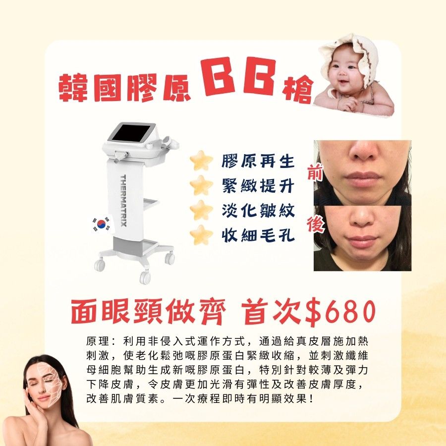 Hifu療程/ 膠原槍療程$680 hifu gold 超聲刀 膠原槍 膠原自生 生膠原 膠原bb槍 射頻療程 瘦面療程 vmax 無針埋線 （分類：美容服務）位於 Hong Kong。 由 littlelaambeauty 提交（商品編號 1320879143，圖片 2）。簡介： 1️⃣Hifu Gold 緊膚索面眼頸療程包500線（即5000多發） 功效： ✅️ 瘦面 ✅️ 提升 ✅️ 緊緻 ✅️ 收毛孔 ✅️ 增加肌膚彈力 流程（60分鐘）： 潔面＞hifu療程＞保濕面膜＞塗護膚品 ❤️新客首次$680❤️ 可加$100透明質酸精華導入 可加$70修眉雜毛 舊客Hifu$1800/3次（9個月內） 🙋‍♀️Q&A 💫Q1:Hifu痛唔痛架？ A1:會有麻酸感，如接受不到麻酸感可選擇做膠原bb槍。 💫Q2:最快可幾耐做一次療程？ A2:1個月 💫Q3:係咪做一兩次就可以keep住v面？ A3:因應個人情況如年齡，生活習慣都有長有短，有恆心可1個月做一次達理想效果。 〰️〰️〰