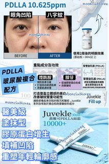 （分類：）位於 。 由 moonclubkorea 提交（商品編號 1439704418，圖片 1）。簡介： 。