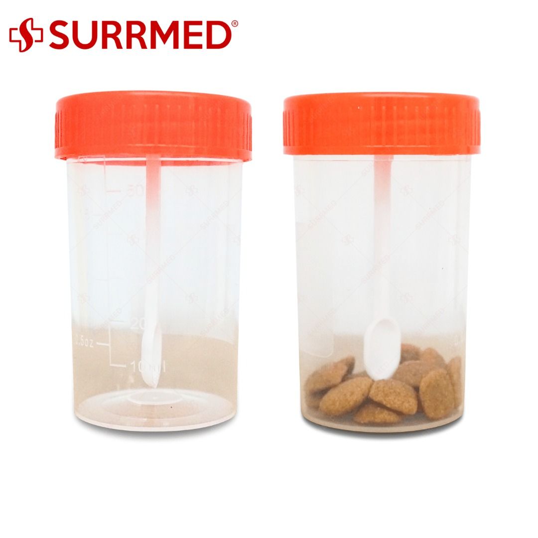 SURRMED STOOL CONTAINER 60ML (Category: Medical Supplies & Tools) located in Quezon City. Submitted by andrea_dxs (Listing ID 1440642520, Image 2). Description: ONHAND RETAIL/BULK ORDERS SAME DAY DELIVERY MODE OF PAYMENT: CASH ON PICK UP, GCASH, AND BANK TRANSFER .