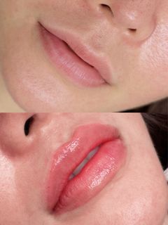(Category: ) located in . Submitted by hersbeauty_ (Listing ID 1443857493, Image 1). Description: .