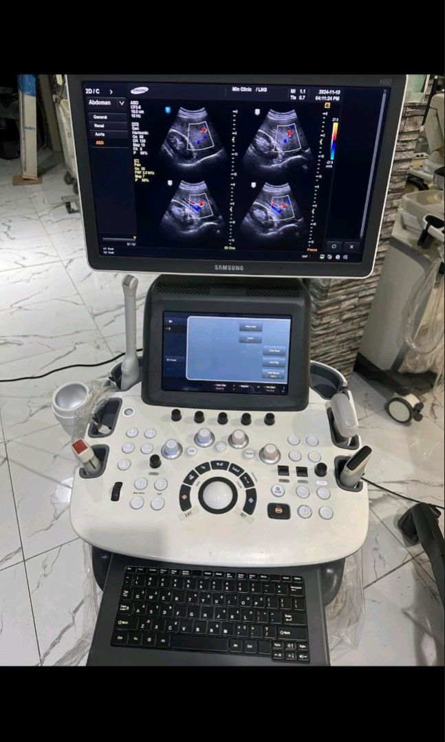 Ultrasound Machine (Category: Medical Supplies & Tools) located in Angeles City. Submitted by ryainramos (Listing ID 1444503770, Image 2). Description: Brand: Samsung H60 4 probes Convex Linear Transvaginal Cardiac/ 2D echo.