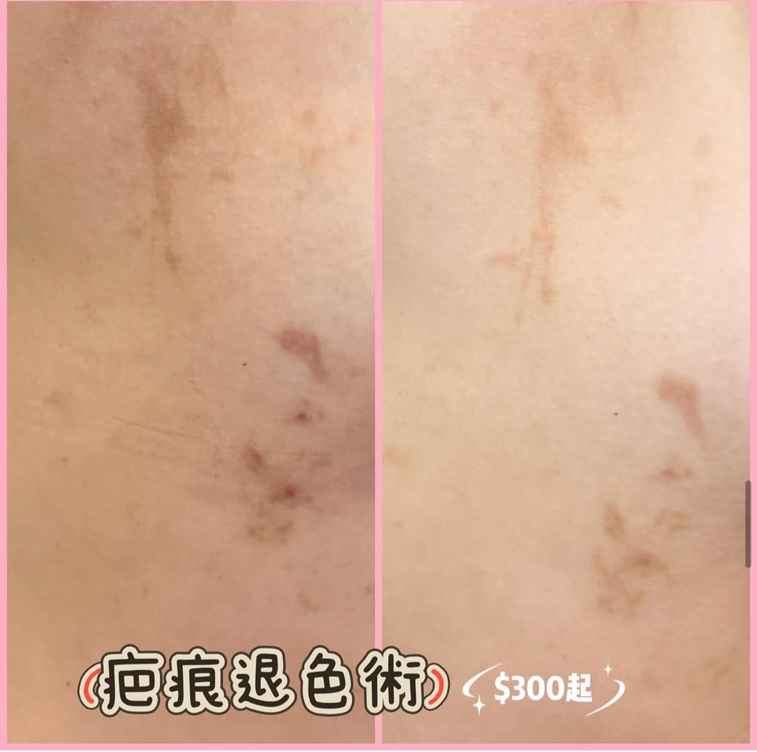 (分類:)位於 。 由 Girlstore 提交(商品編號 1442354588,圖片 1)。簡介: 。