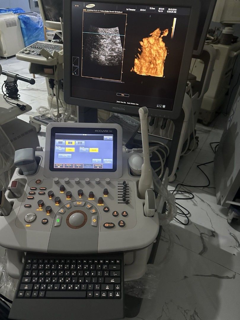 Ultrasound machine (Category: Medical Supplies & Tools) located in Angeles City. Submitted by ryainramos (Listing ID 1442587479, Image 1). Description: Brand: Samsung XG 4 probes 2D echo/ cardiac Convex Linear Transvaginal.